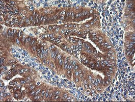 UBE2J1 Antibody (clone OTI3D1)