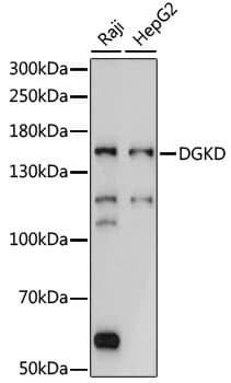 Polyclonal Rabbit anti-Human DGKD Antibody (WB)
