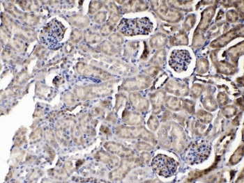 PNP / Nucleoside Phosphorylase Antibody