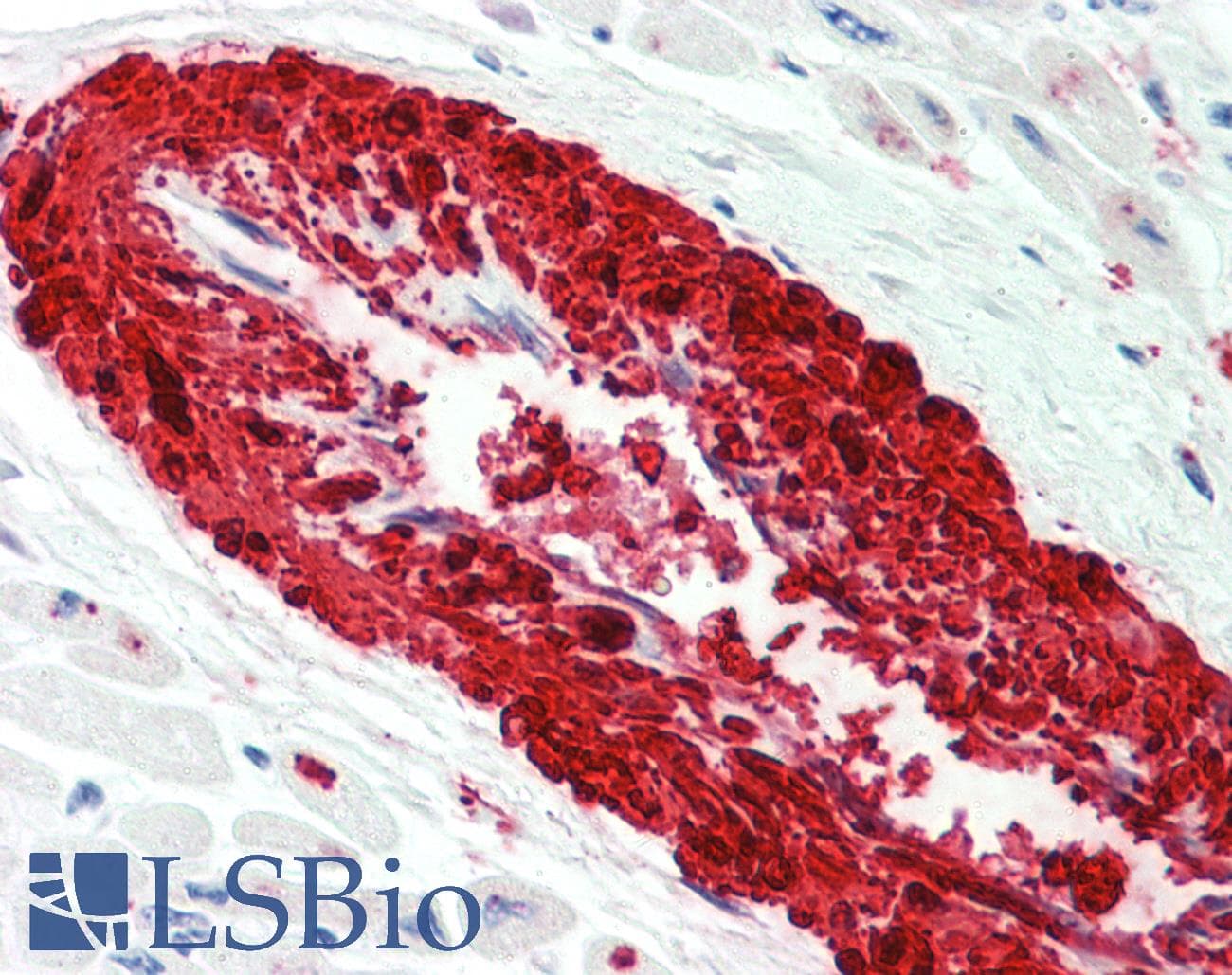 IHC-plus™ TAGLN / Transgelin / SM22 Antibody (clone 8C8)