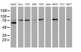 CTNNB1 / Beta Catenin Antibody (clone OTI6E7)
