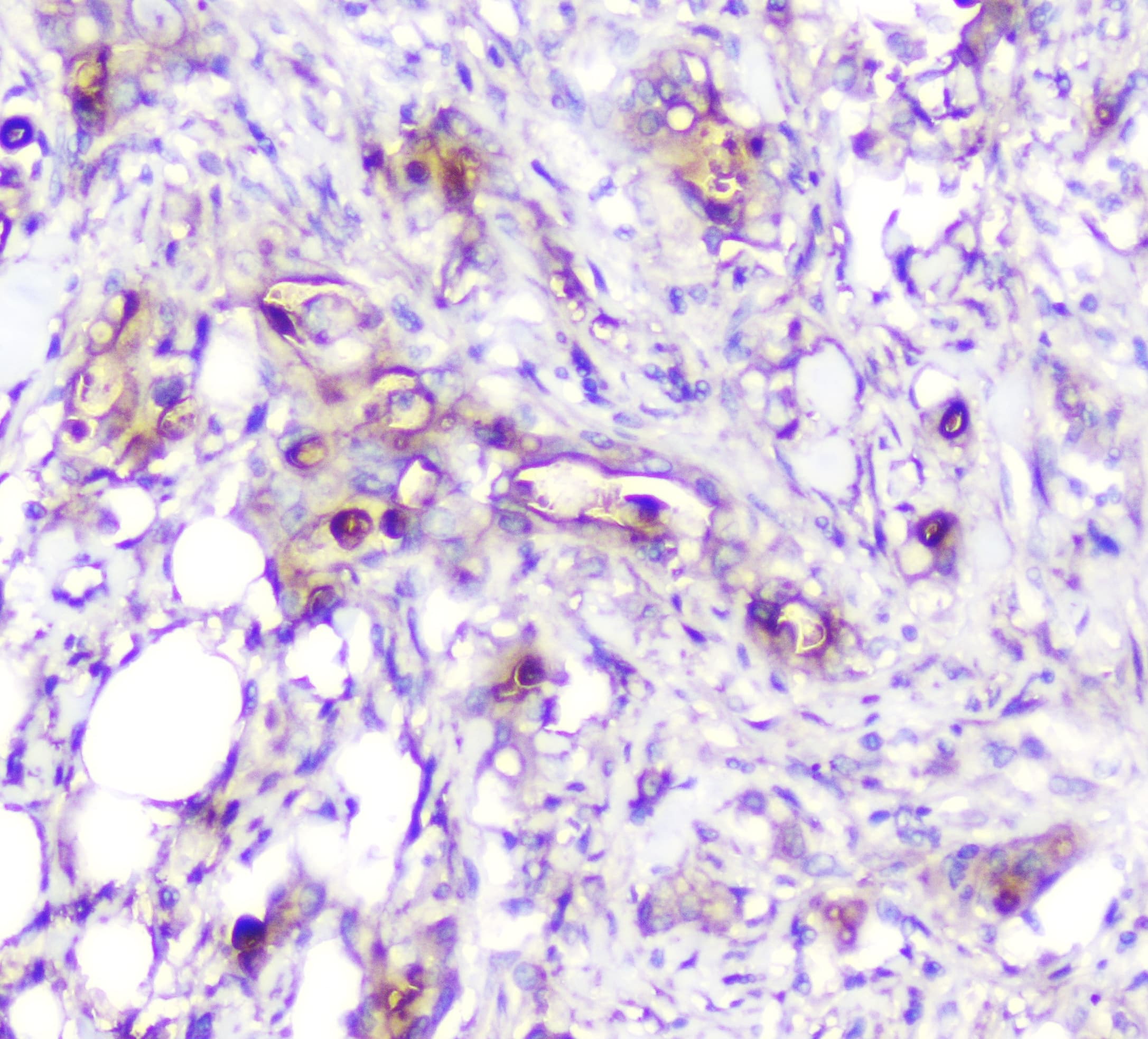 ADA / Adenosine Deaminase Antibody