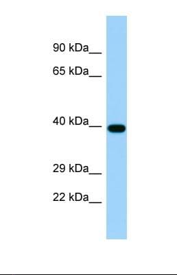 TICAM2 / TRAM Antibody (aa168-217)