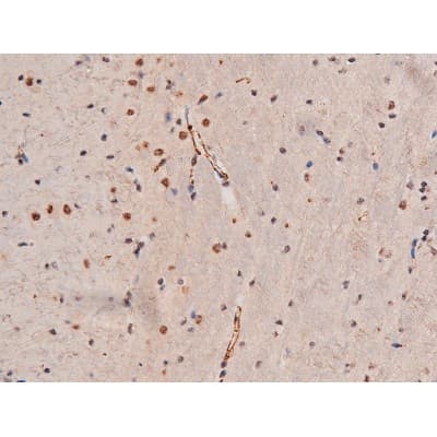 STAT3 Antibody (phospho-Ser727)