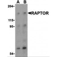 IHC-plus™ Raptor / Mip1 Antibody