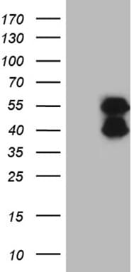 BCL7B Antibody (clone OTI4B10)