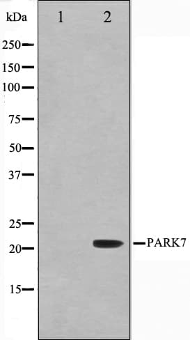 Polyclonal Rabbit anti-Human PARK7 / DJ-1 Antibody (IF, WB)