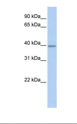 TXNIP Antibody (C-Terminus)