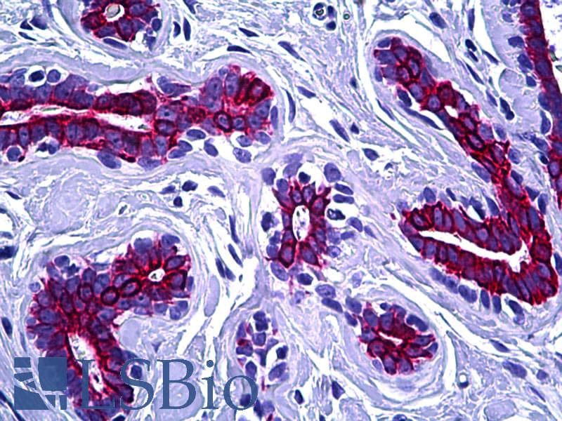 IHC-plus™ Cytokeratin 8+18+19 Antibody (clone 2A4, Concentrated)