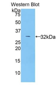MYO1B / Myosin IB Antibody (aa779-1040, Biotin)