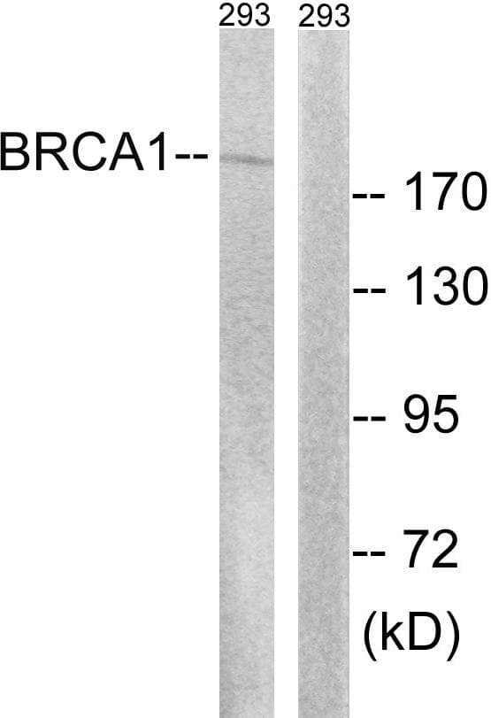 Polyclonal Rabbit anti-Human BRCA1 Antibody (p1457, WB)