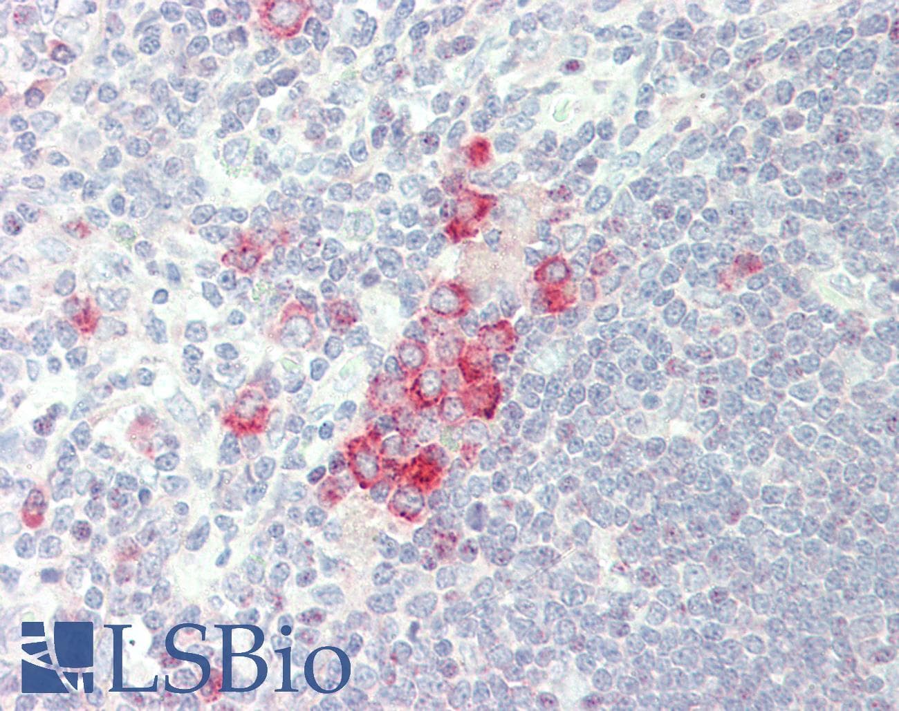 IHC-plus™ RNF125 / TRAC-1 Antibody (aa131-180)