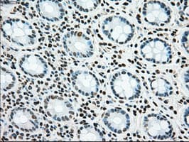 SSB / La Antibody (clone OTI2C8)