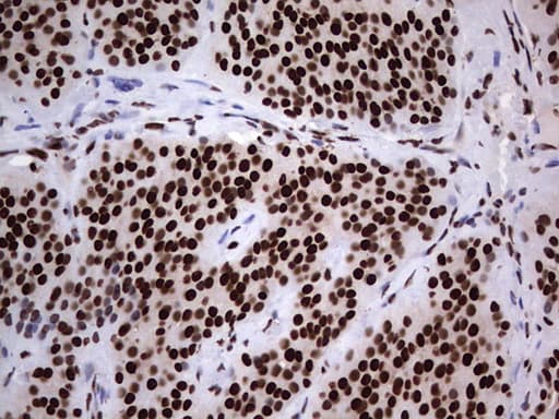 HNRNPL / hnRNP L Antibody (aa270-502, clone OTI2E4)