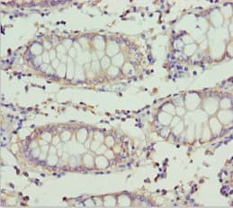 Polyclonal Rabbit anti-Human ETFA Antibody (IHC, WB)