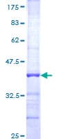 Human FBXO7 Protein (Recombinant GST, N-terminus)