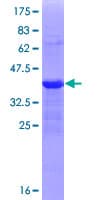 Human ZEB1 / AREB6 Protein (Recombinant GST, N-terminus)
