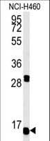 HIST1H1B Antibody (aa33-60)