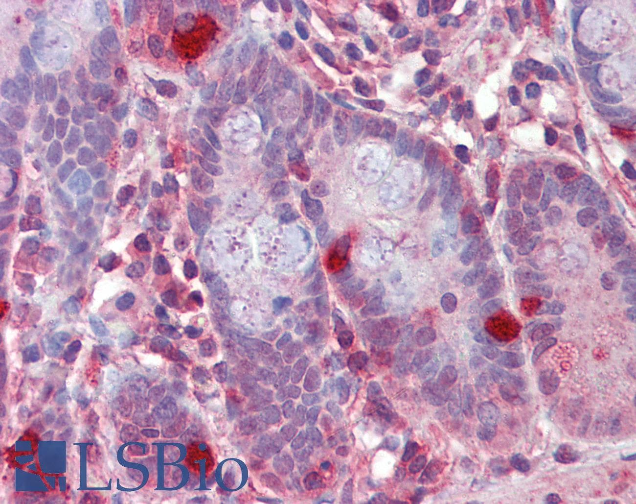 IHC-plus™ RGS1 Antibody (aa198-209)