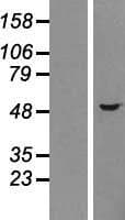 CHKA / CK / Choline Kinase Protein (Over-Expression Lysate Myc-DDK (Flag))