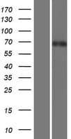 TOR1AIP1 / LAP1 Protein (Over-Expression Lysate Myc-DDK (Flag))