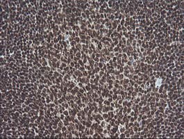 Monoclonal Mouse anti-Human MAPK3 / ERK1 Antibody (clone OTI4D7, IHC, IF, WB)