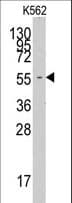 FARSA Antibody (aa54-83)