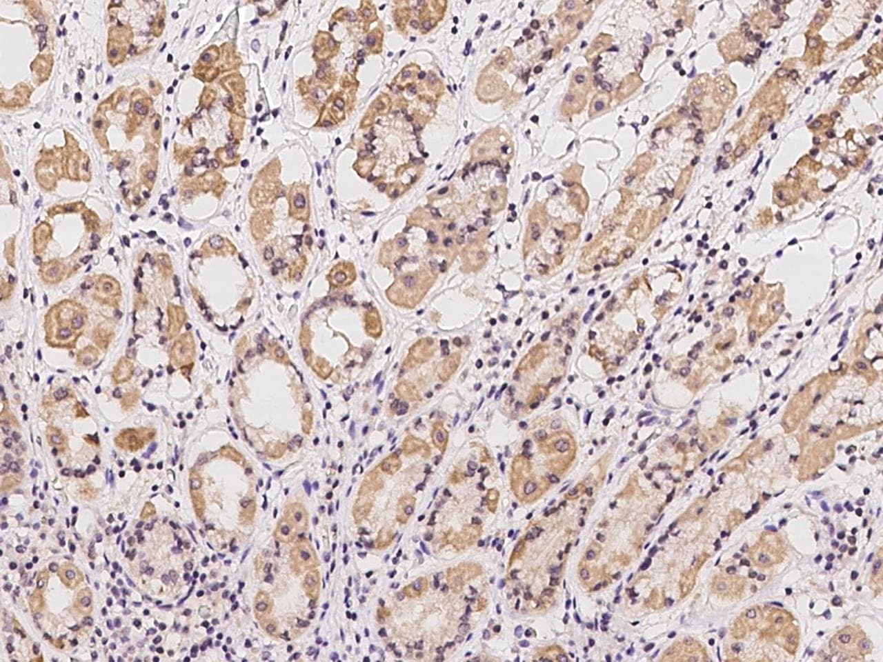 Polyclonal Rabbit anti-Human PNKD Antibody (IHC)