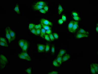 Polyclonal Rabbit anti-Human PSAT1 Antibody (IHC, IF)