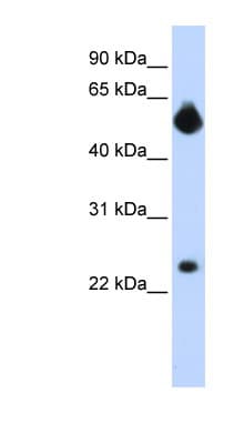 NOTCH4 Antibody (Internal)