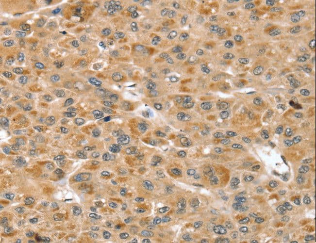 Polyclonal Rabbit anti-Human RNH1 Antibody (IHC, WB)