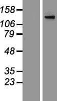 ADCY2 / Adenylate Cyclase 2 Protein (Over-Expression Lysate Myc-DDK (Flag))