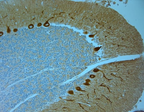 Polyclonal Rabbit anti-Human ITPR1 / IP3 Receptor Type 1 Antibody (aa700-750, IHC)