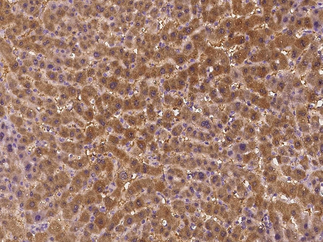 STARD5 Antibody