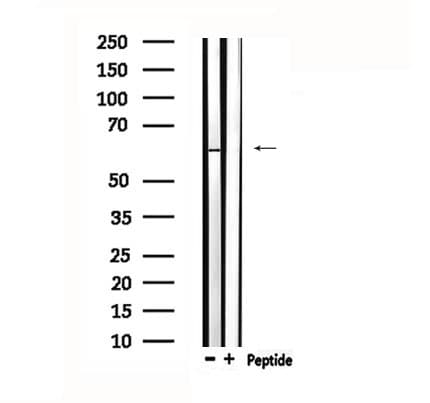 Polyclonal Rabbit anti-Human TESK2 Antibody (WB)