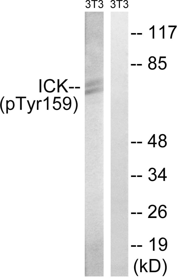 ICK Antibody (phospho-Tyr159)