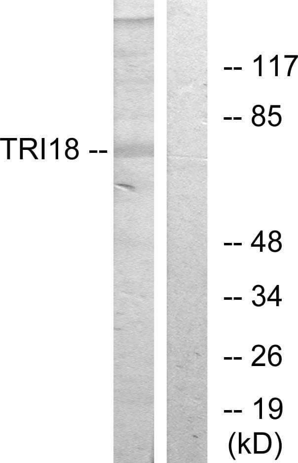 MID1 Antibody