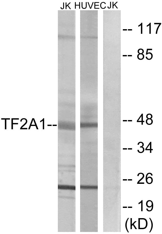 IHC-plus™ Polyclonal Rabbit anti-Human GTF2A1 / TFIIA Antibody (aa281-330, IHC, WB)
