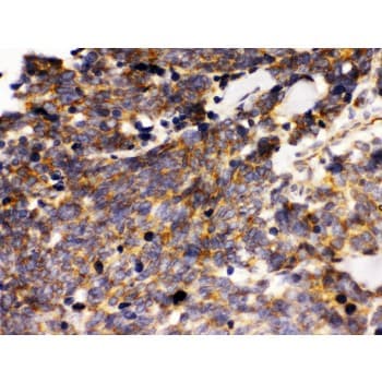 PTPRF Antibody (aa1167-1203)