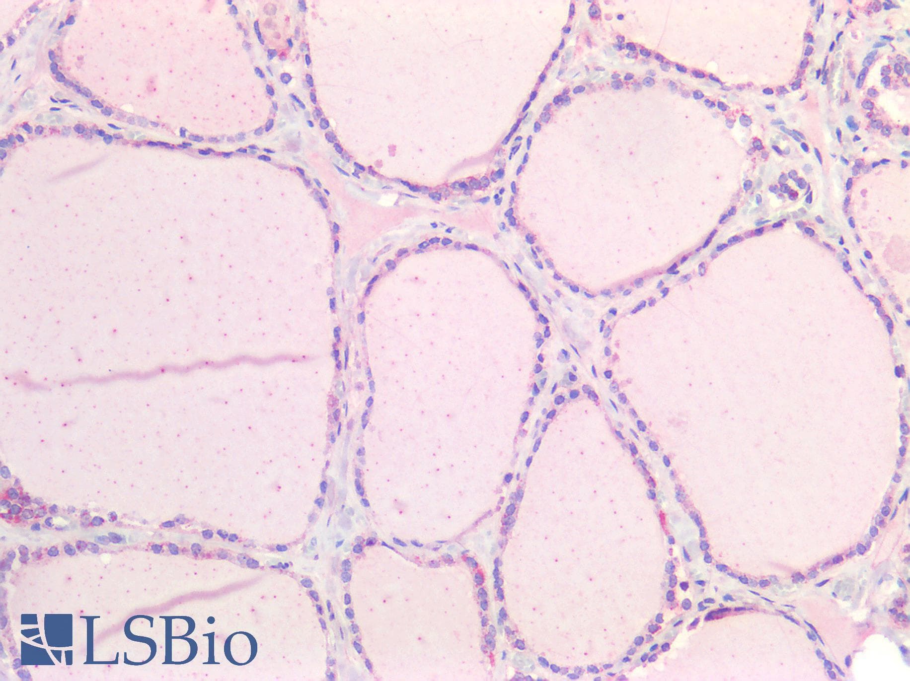 IHC-plus™ ALK2 / ACVR1 Antibody
