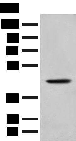 HLA-B Antibody