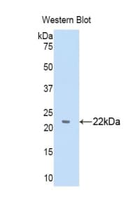 A1BG Antibody (aa22-206)