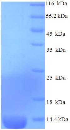 Mouse CCL2 / MCP1 Protein (Recombinant His)