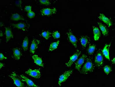 BACE1 / BACE Antibody