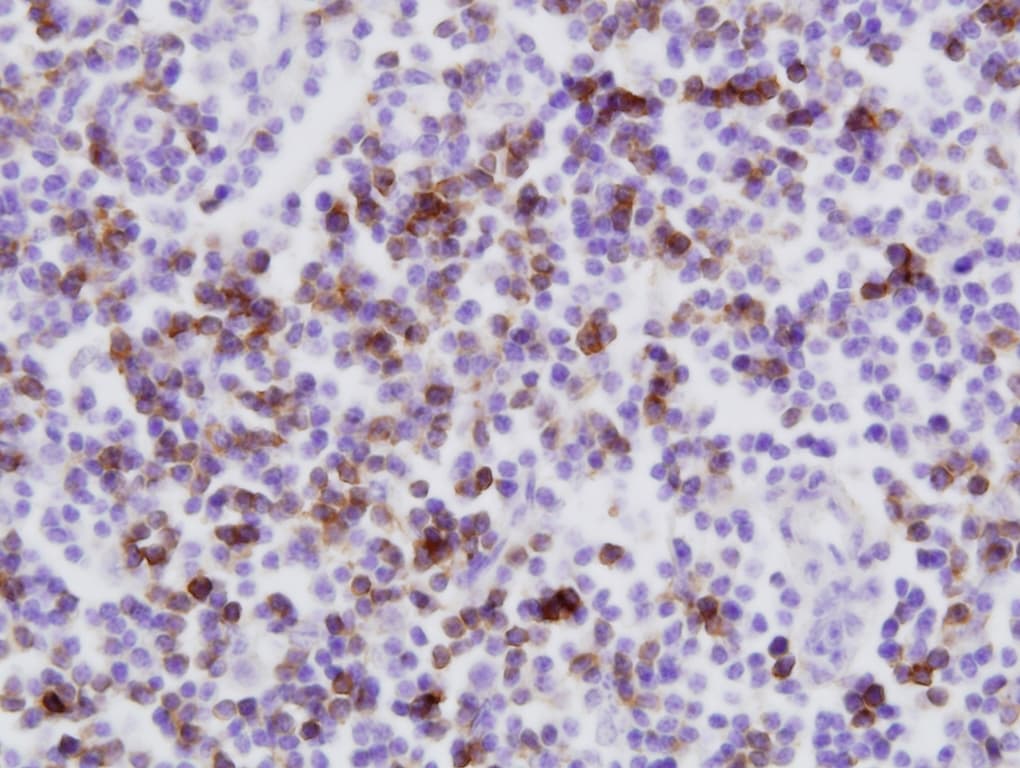 CD8 Antibody (clone CC63)