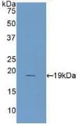 Human IL1RN Protein (Recombinant His, N-Terminal)