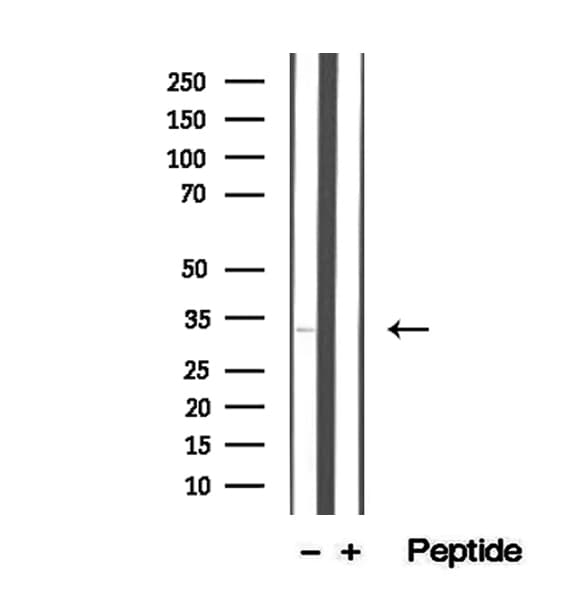 STC2 / Stanniocalcin 2 Antibody