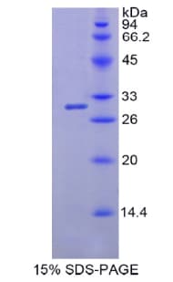 Human MYH4 Protein (Recombinant His)