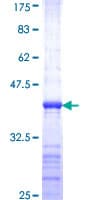 Human ASCL1 / MASH1 Protein (Recombinant GST, N-terminus)