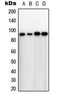 Polyclonal Rabbit anti-Human TLK1 Antibody (Internal, WB)